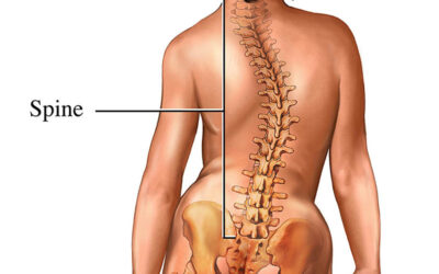 Best Scoliosis Doctor in Delhi NCR