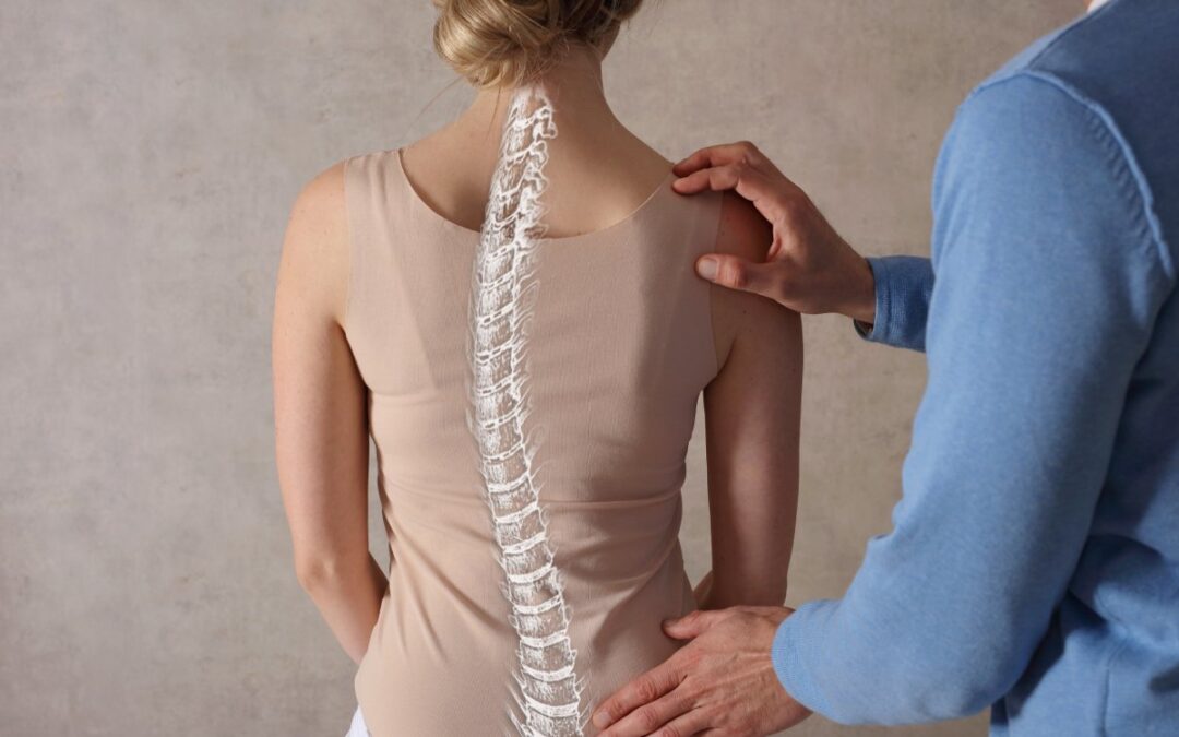 Scoliosis Surgery