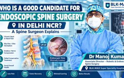 Who Is a Good Candidate for Endoscopic Spine Surgery in Delhi NCR